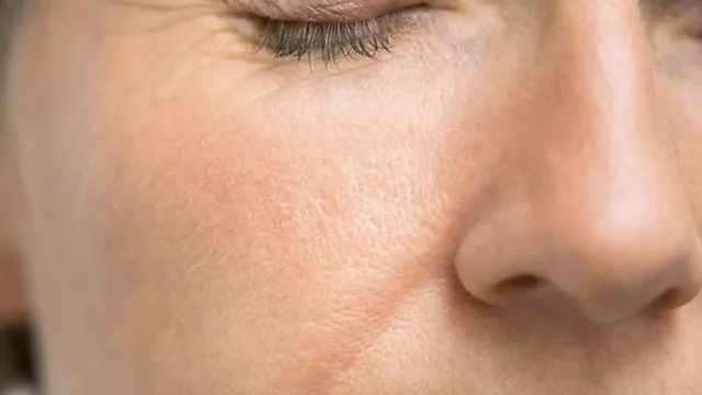 رفع چروک های صورت با روش های ساده؛ یکبار برای همیشه این مشکلو حل کن